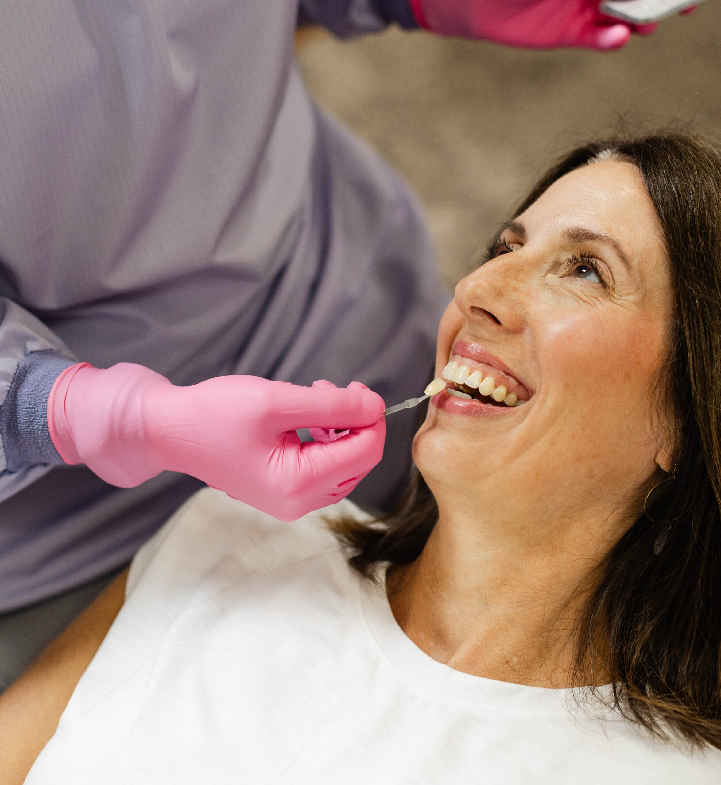 Professional teeth whitening at Cornell Family Dental